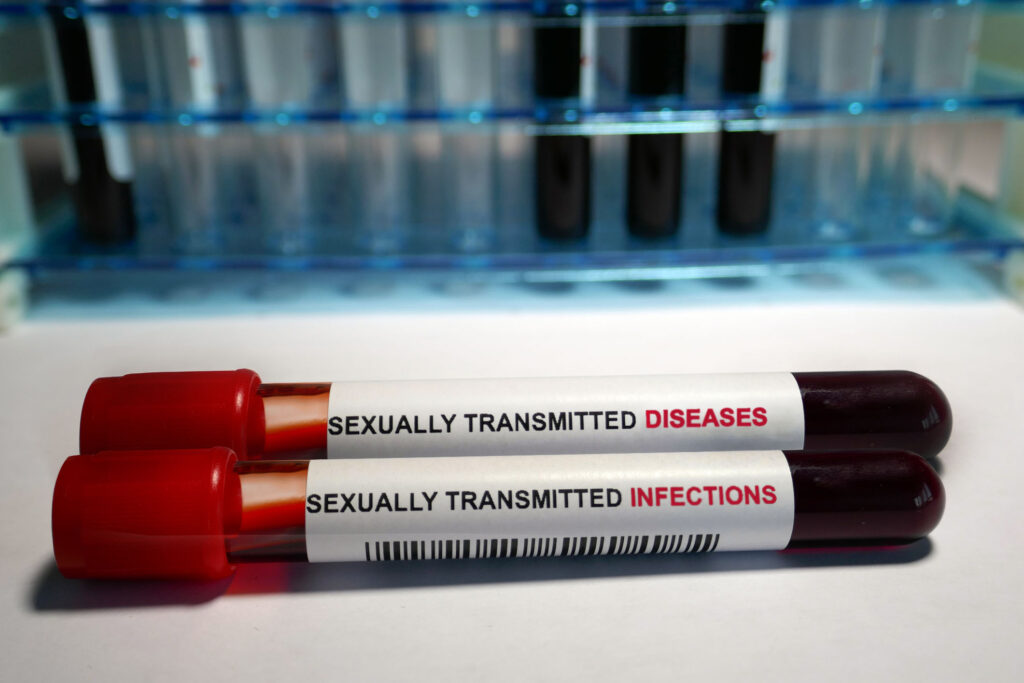 IST- Infeksione Seksualisht te Transmetueshme