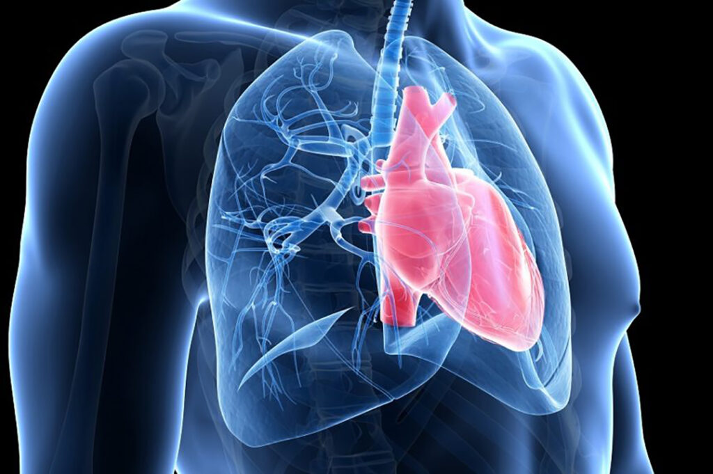 Problemet kardiovaskulare mund te jene nje komplikim nga mungesa e oksigjenit e shkaktuar nga pnumonia.