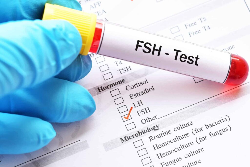 FSH- test per te ndihmuar ne diagnostikimin e menopauzes