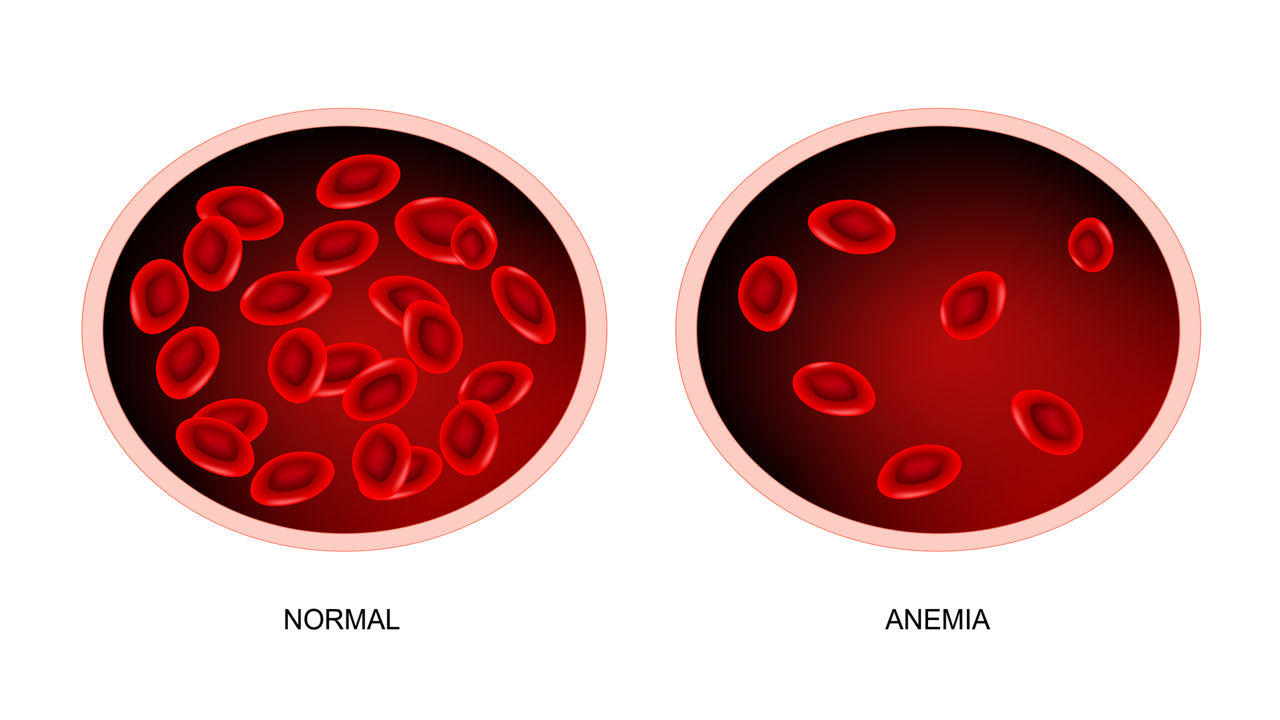 Гемоглобин 65 у мужчины. Гемоглобин. Эритроциты. Эритроциты в крови анемия. Гемоглобин норма.