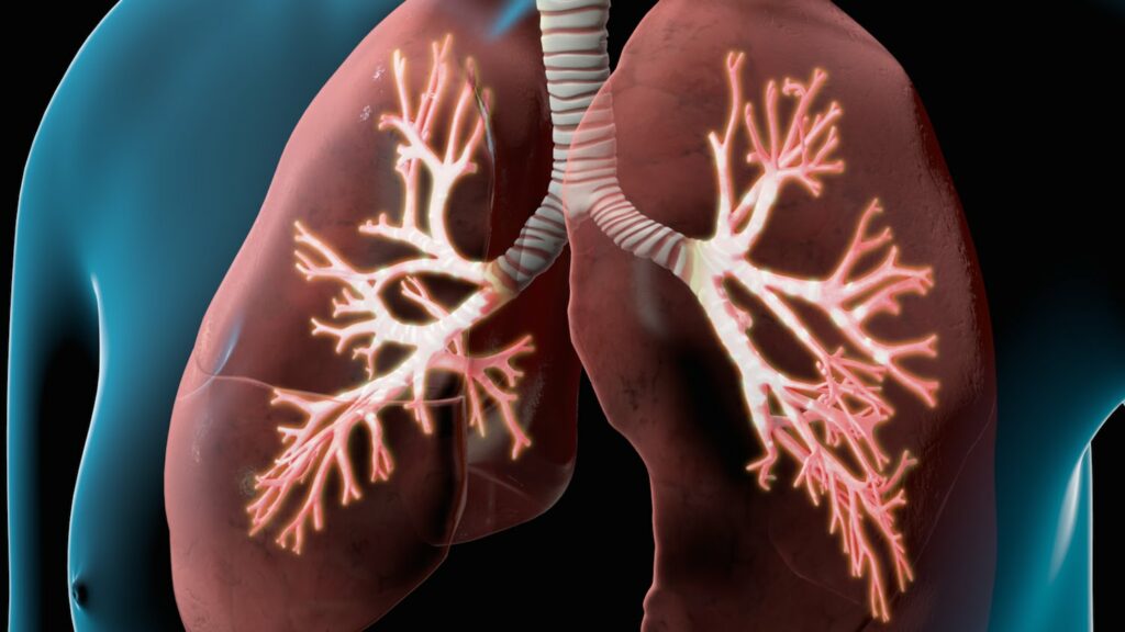 Semundje pulmonare obstruktive kronike